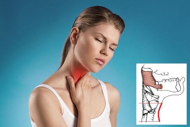 ból gardła z osteochondrozą szyjną