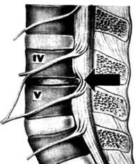 X -Ray Zdjęcie Departamentu Osteochondrozy Lędźwiowego