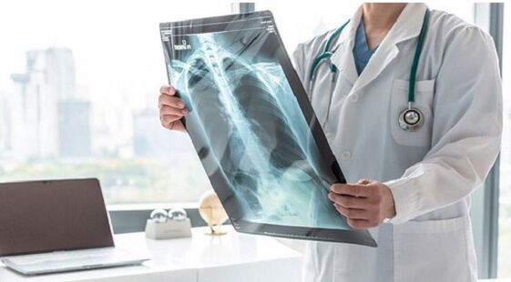 Diagnostyka RTG bólu pod lewą łopatką