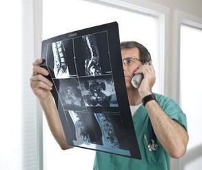 Mielografia w diagnostyce osteochondrozy i przepuklin międzykręgowych