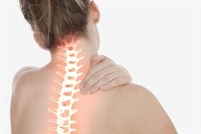 Osteochondroza szyjna u kobiety